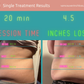 Tummy & Belly Contouring Treatments